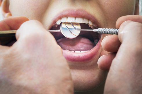Apakah Tambal Gigi Ditanggung BPJS Kesehatan? Simak Prosedurnya