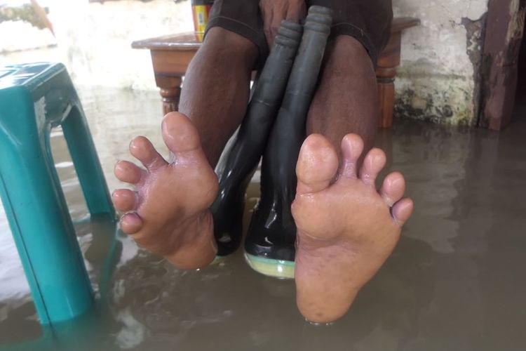 Warga korban banjir Lumajang merasakan gatal-gatal, Kamis (17/3/2022)