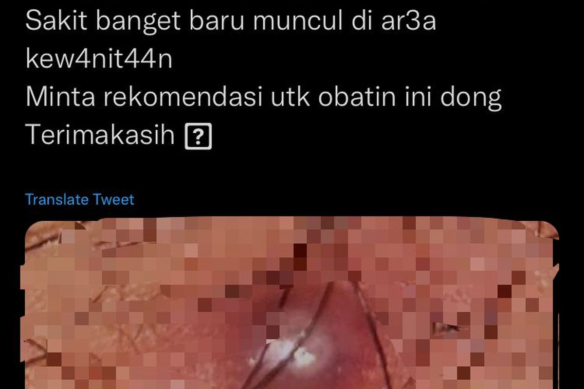 Ramai soal jerawat muncul di area kewanitaan.