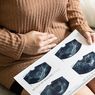 5 Fungsi Plasenta yang Perlu Ibu Hamil Ketahui