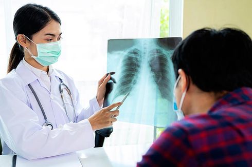 Dokter Ingatkan Masyarakat untuk Waspadai TBC Laten yang Tak Bergejala