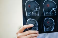 12 Cara Mencegah Penyakit Otak yang Membahayakan