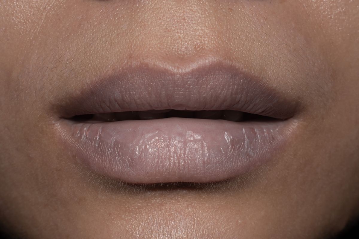 Ilustrasi bibir hitam, mengapa warna bibir hitam padahal tidak merokok, penyebab bibir hitam, cara mencerahkan bibir hitam. 