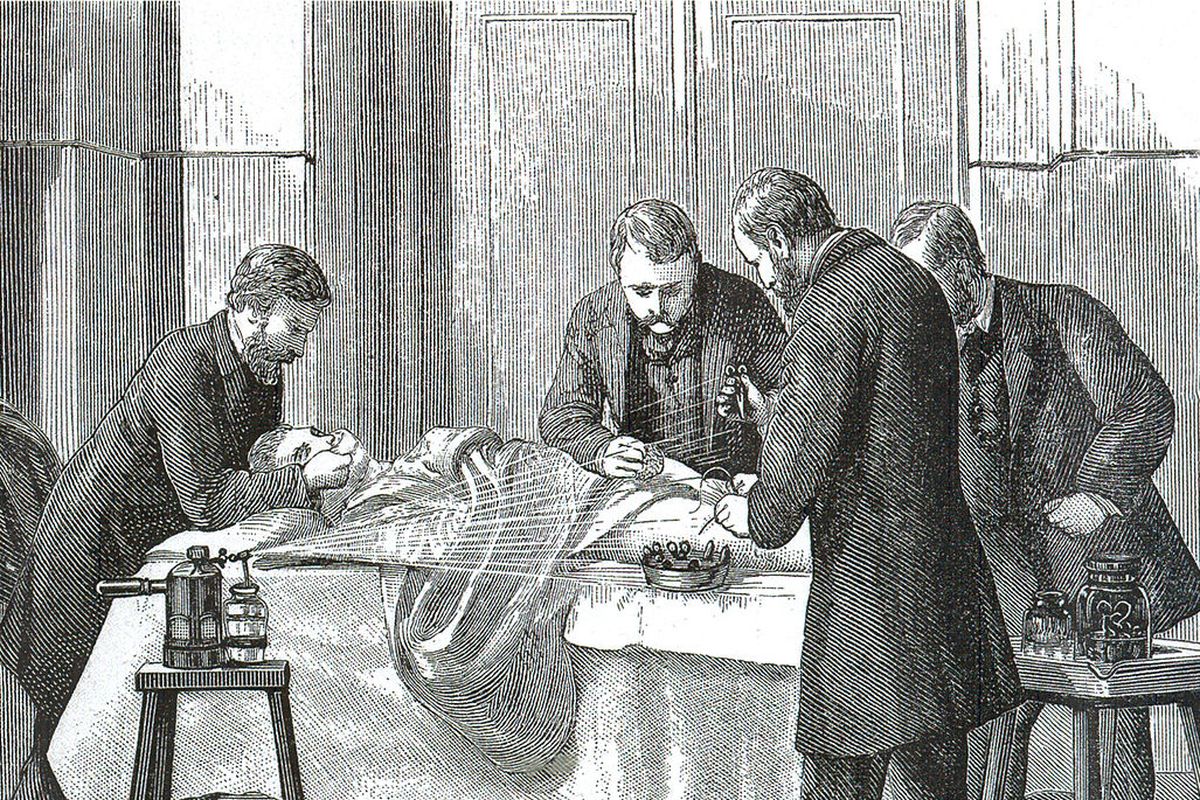 Joseph Lister menyemprotkan cairan fenol di atas luka saat para dokter sedang melakukan operasi. Penemuan antiseptik ini telah menyelamatkan jutaan nyawa di dunia.