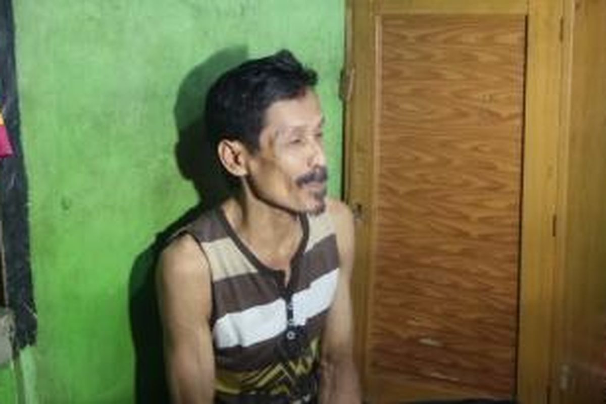 Sinin alias Kong Naim (62) pria yang diklaim dapat bertelur, setelah pulang dari perawatan di RSUD Koja, Jakarta Utara. Senin (10/11/2014) 