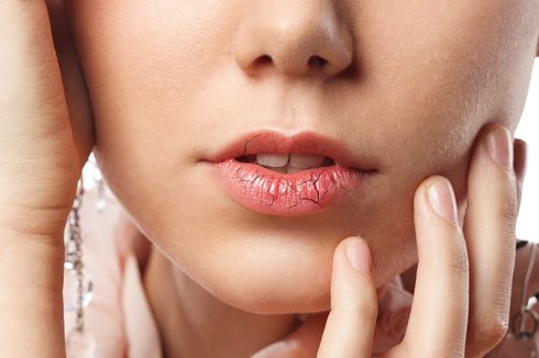 5 Cara Alami Hilangkan Bibir Pecah-pecah, Sudah Tahu?