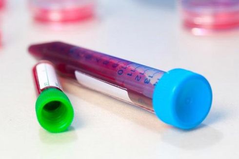Ilmuwan Australia Kembangkan Tes Darah yang Bisa Deteksi Kanker Kulit