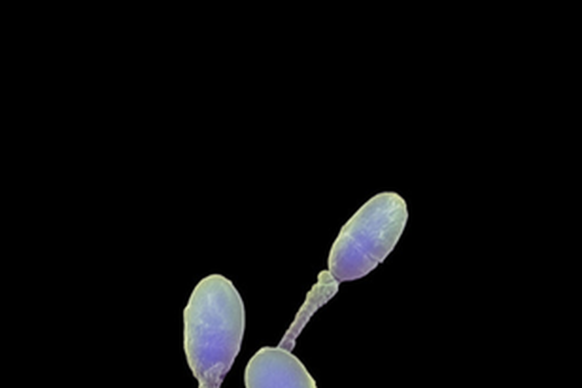 Selama ini alat kontrasepsi bagi pria hanya kondom atau vasektomi.