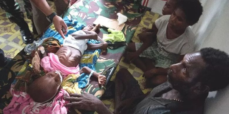 Kelaparan Papua 2018. Sebuah keluarga menemani anaknya yang menderita kekurangan gizi di sebuah rumah sakit di Agats.