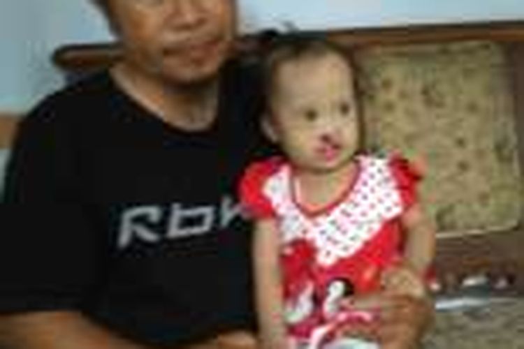 Hariyadi (42) memangku anaknya, Azizah, yang menderita bibir sumbing, down syndrom dan kelainan jantung, ditemui di rumahnya di Kampung Prajuritan Bawah, RT 02, RW 10, Kelurahan Wonosobo Timur, Kabupaten Wonosobo, Minggu (23/101/2016)