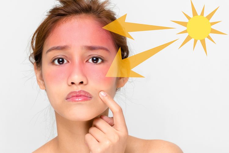 Alergi kulit bisa muncul karena kandungan bahan kimia sunscreen.