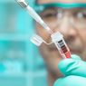 Update Penemuan Vaksin, dari Peneliti Terkemuka Arab Saudi Sampai Persiapan Uji Vaksin di Rusia