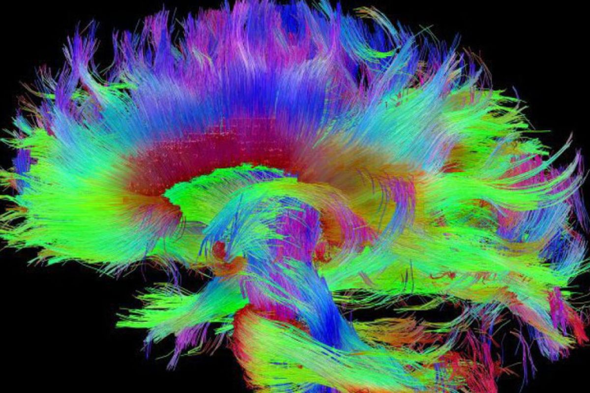 Peta otak manusia sehat
