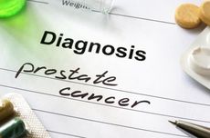 Kanker Prostat: Gejala, Penyebab, Pencegahan dan Cara Mengatasinya