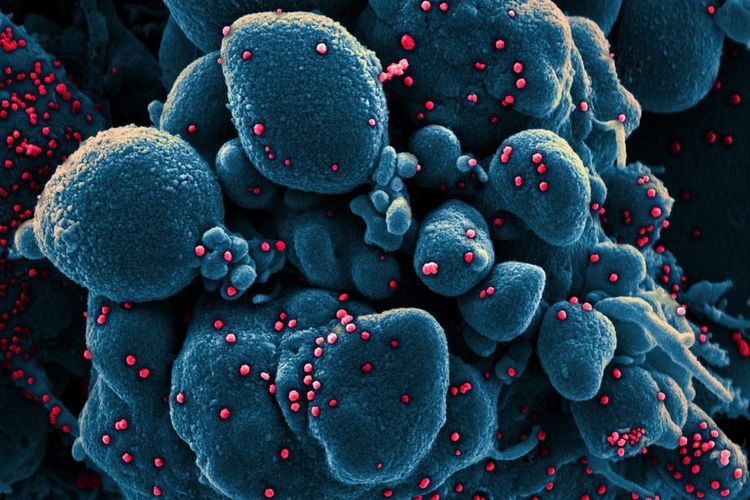 Gambar selebaran tanpa tanggal yang diambil dan ditingkatkan warnanya di National Institute of Allergy and Infectious Diseases (NIAID) Fasilitas Riset Terpadu (IRF) di Fort Detrick, Maryland, AS dan yang disediakan oleh National Institutes of Health (NIH) menunjukkan warna pemindaian mikrograf elektron dari sel apoptosis (biru) yang terinfeksi partikel virus SARS-COV-2 (merah), diisolasi dari sampel pasien (dikeluarkan 24 Maret 2020). EPA-EFE/NIAID/NATIONAL INSTITUTES OF HEALTH HANDOUT  HANDOUT EDITORIAL USE ONLY/NO SALES