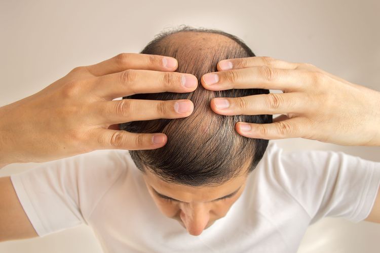 Ilustrasi seorang pria sedang memijat kulit kepala sebagai perawatan kebotakan.