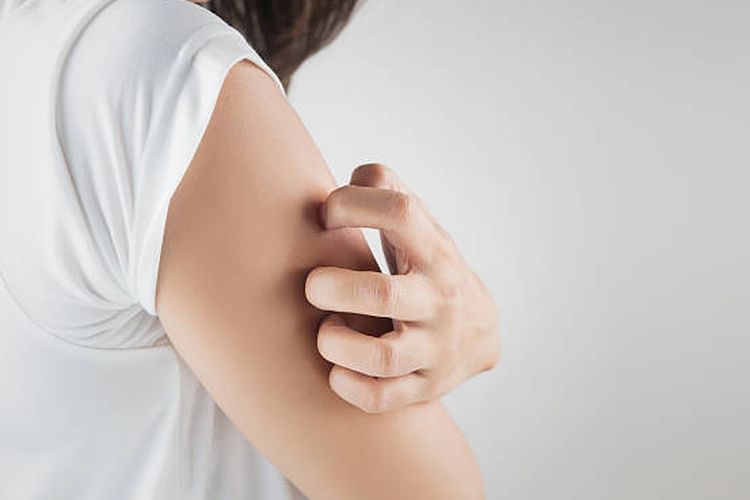 Rasa gatal di area kulit adalah salah satu gejala eksim basah yang perlu diwaspadai.