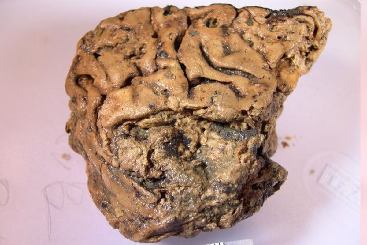 Pada tahun 2008 peneliti menemukan jaringan otak berusia 2600 tahun yang masih terawetkan.