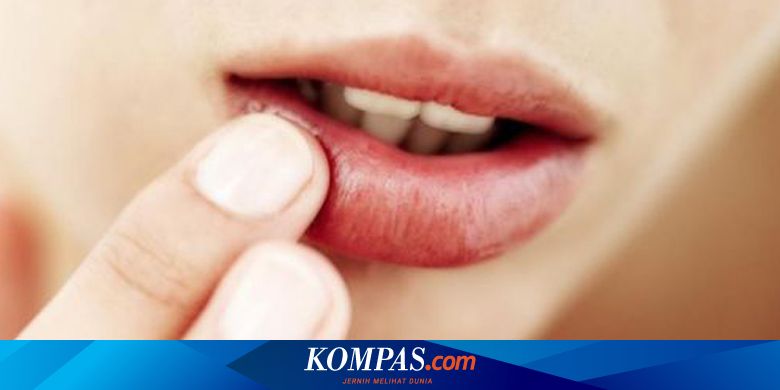 Mengatasi Bibir Menghitam Dengan Lemon Halaman All Kompas Com