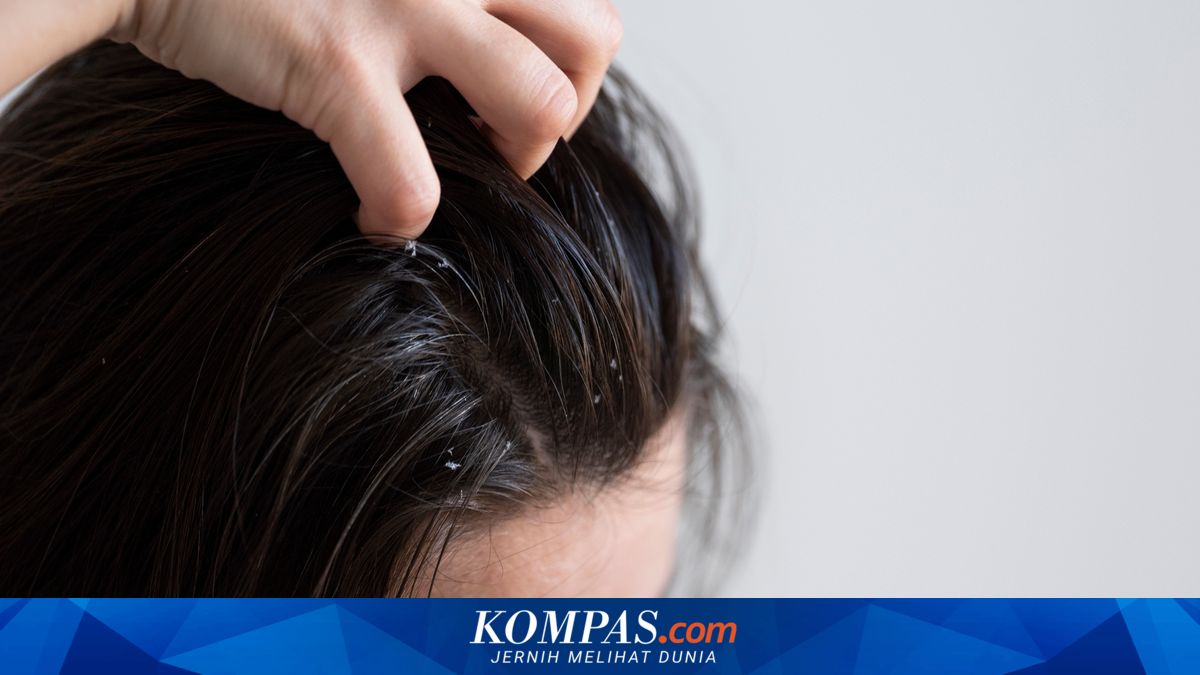 Benarkah Ketombe dan Kulit Kepala Gatal Picu Rambut Rontok?