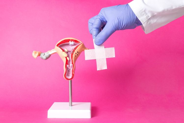 Ilustrasi vagina, bibir vagina bengkak, penyebab bibir vagina bengkak