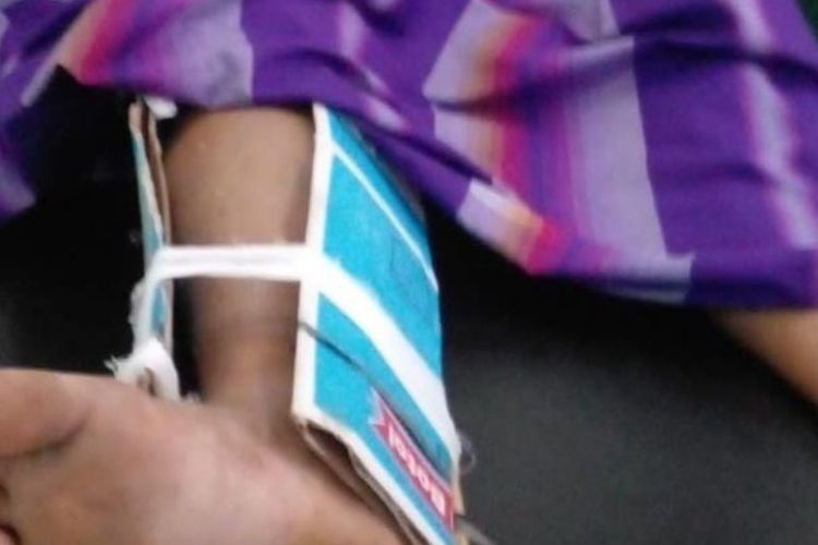 Warga Kabupaten Lebak korban gigitan ular di kawasan pedalaman Badui dirujuk ke RSUD Banten untuk ditangani secara medis.