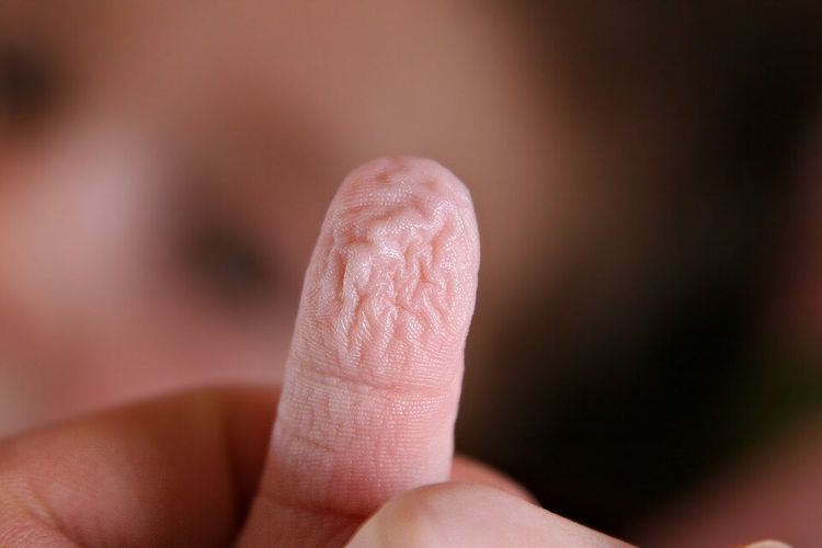 Kenapa Tangan Keriput Saat Terkena Air? Ini Penjelasan Ilmiahnya!