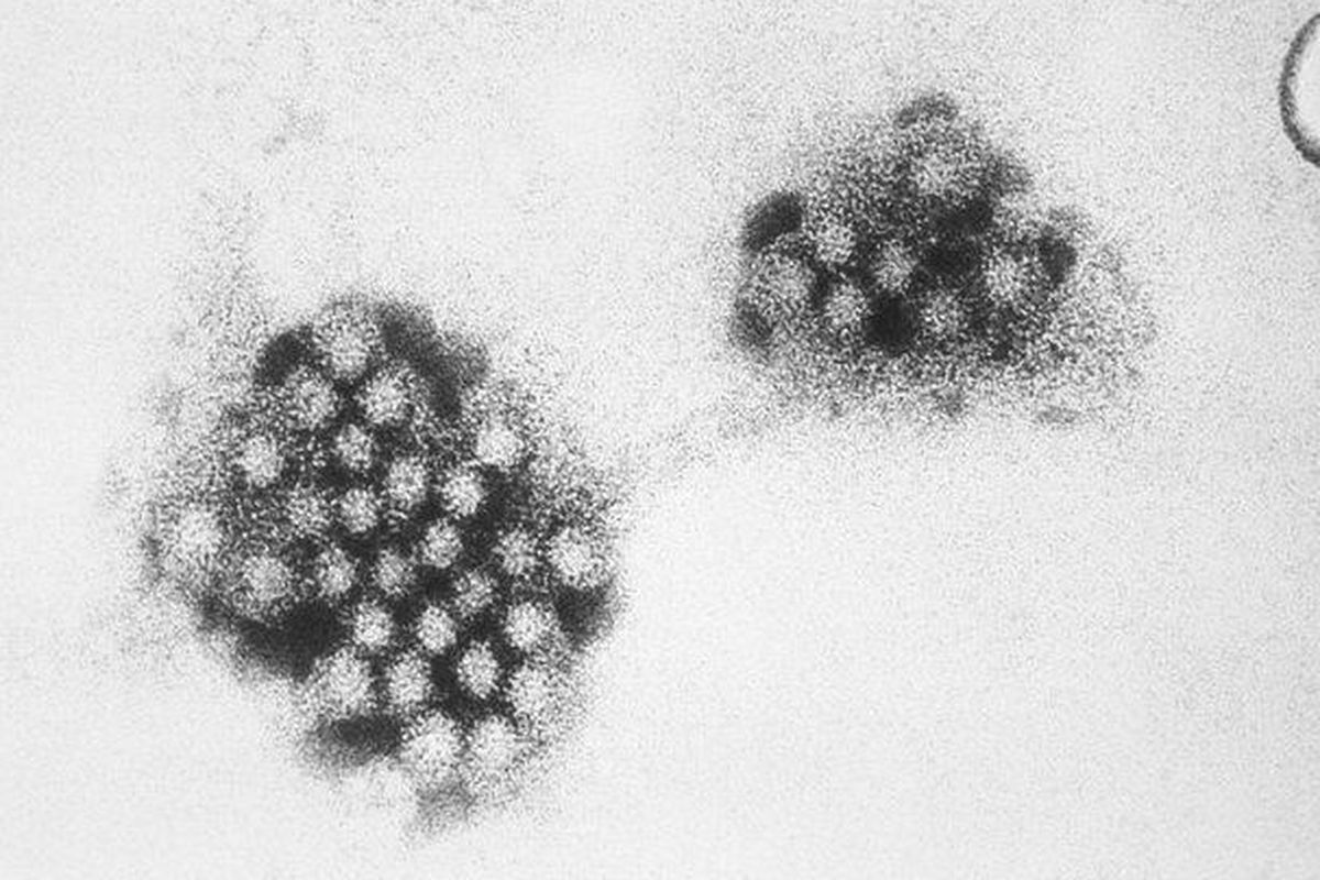 Ilustrasi norovirus. Kasus norovirus meningkat di beberapa wilayah AS sejak akhir 2024. Ini adalah virus yang sangat menular dan menyebabkan muntah serta diare parah.