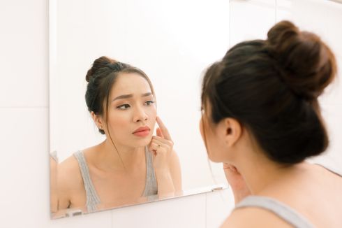 3 Tips Mengatasi Masalah Adult Acne