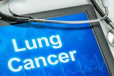 Mengenal Macam-macam Pengobatan untuk Kanker Paru