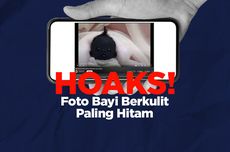 INFOGRAFIK: Beredar Hoaks Foto Bayi Berkulit Paling Hitam, Simak Faktanya