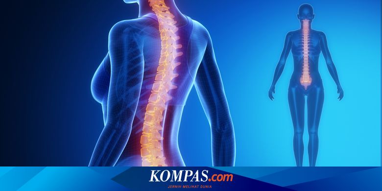 2 Cara Memperbaiki Tulang Belakang Yang Terlanjur Bengkok Halaman All Kompas Com