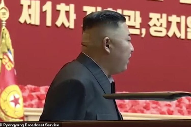 Pemimpin Korea Utara Kim Jong Un ketika hadir dalam parade militer akhir Juli lalu. Dalam potongan video, nampak terdapat plester di bagian belakang kepalanya.