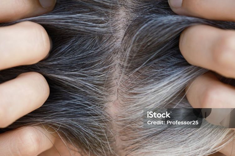 Bisakah Rambut Beruban Kembali ke Warna Semula?