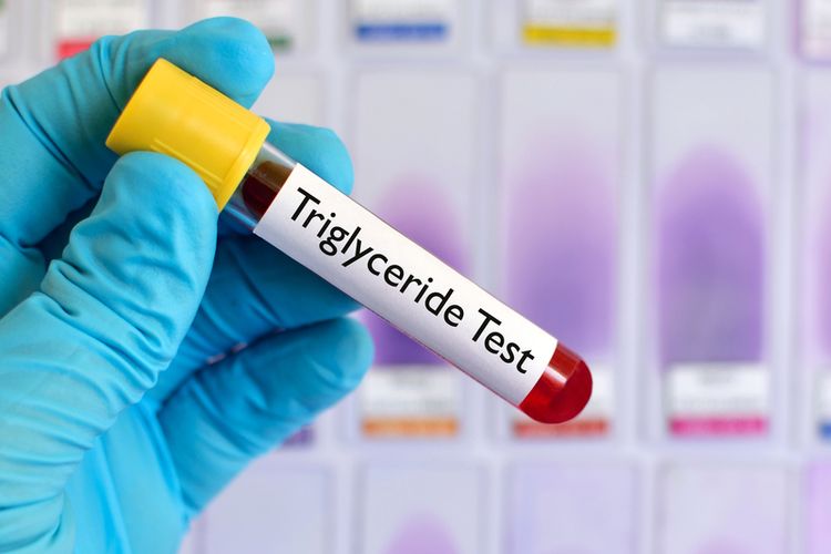 Sebagian orang mungkin bertanya-tanya mengenai cara mengatasi trigliserida tinggi secara alami atau tanpa obat. 