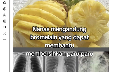 Makan Nanas Disebut Bisa Bantu Bersihkan Paru-paru Perokok ...