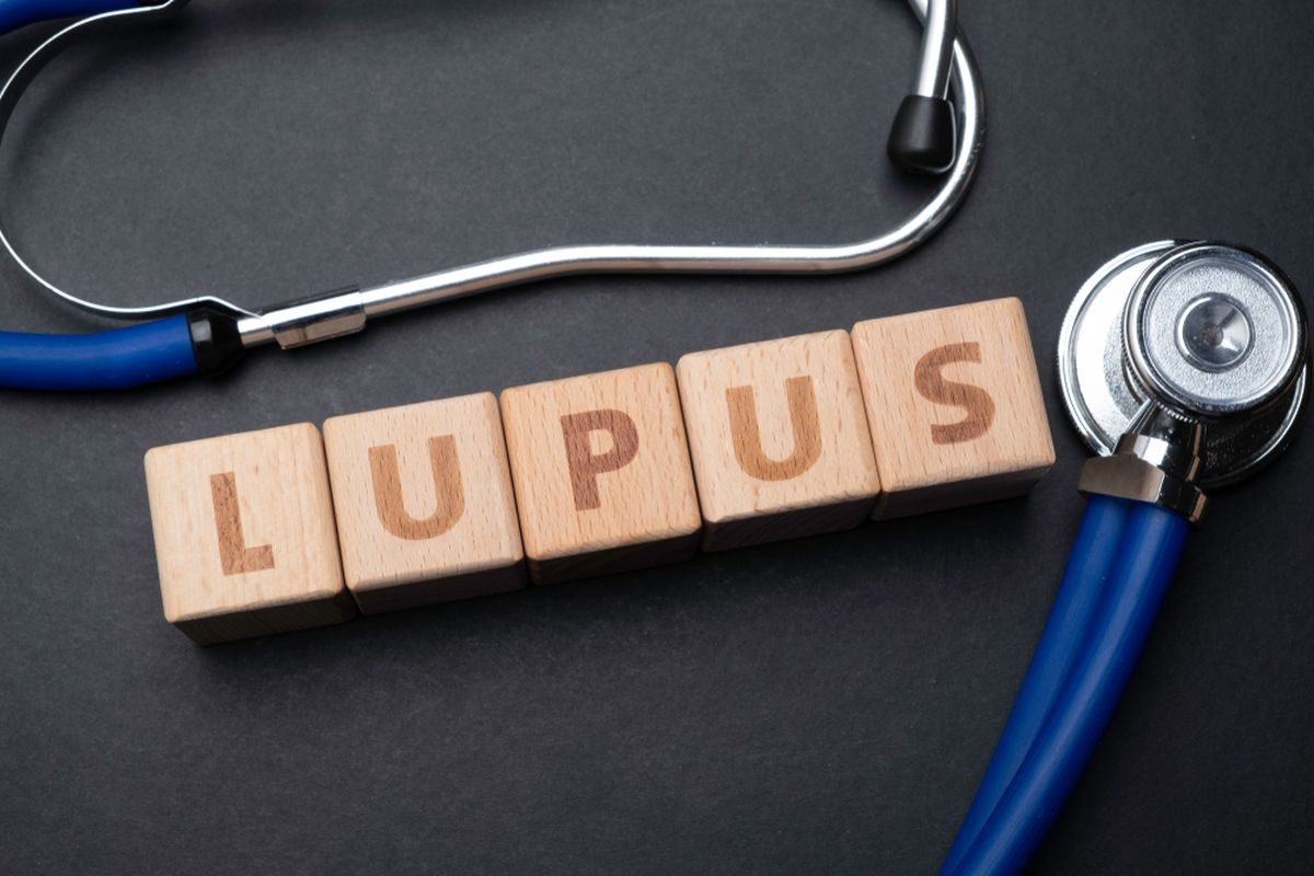 Ilustrasi penyakit lupus. Penyakit lupus adalah penyakit autoimun. Ini terdiri dari 4 jenis. Lupus eritematosus sistemik adalah jenis lupus yang paling umum.