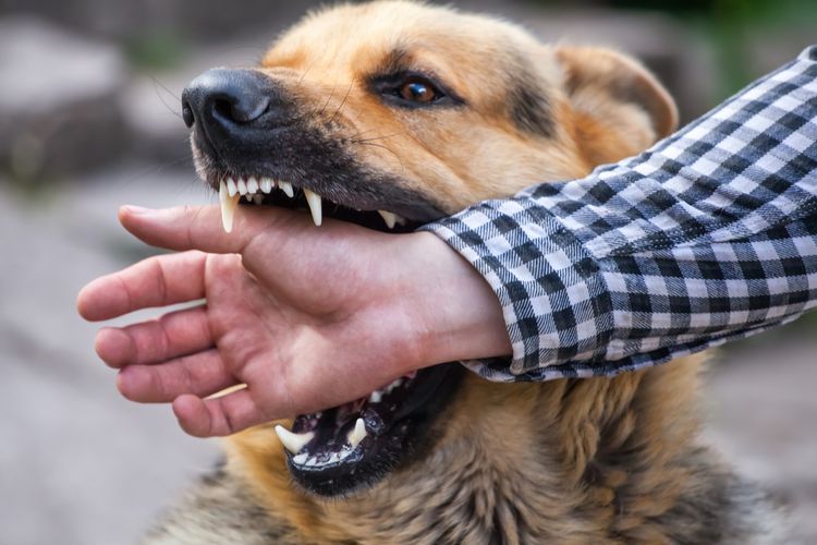 Melakukan langkah pertolongan pertama yang harus dilakukan jika digigit anjing sangat penting untuk menghindari infeksi.