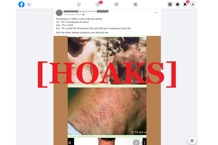 Tangkapan layar unggahan hoaks di sebuah akun Facebook, Senin (23/5/20222), yang mengaitkan monkeypox atau cacar monyet dengan vaksin dan VAIDS.