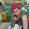Pria Ini Mengerang Kesakitan Saat Tatonya Dihapus Pakai Laser
