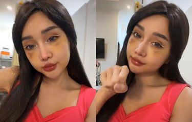 Ketika Wajah Baru Lucinta Luna Pascaoperasi Disebut Mirip Idol ...