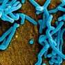 Apakah Virus Marburg Berpotensi Masuk ke Indonesia? Ini Kata Epidemiolog