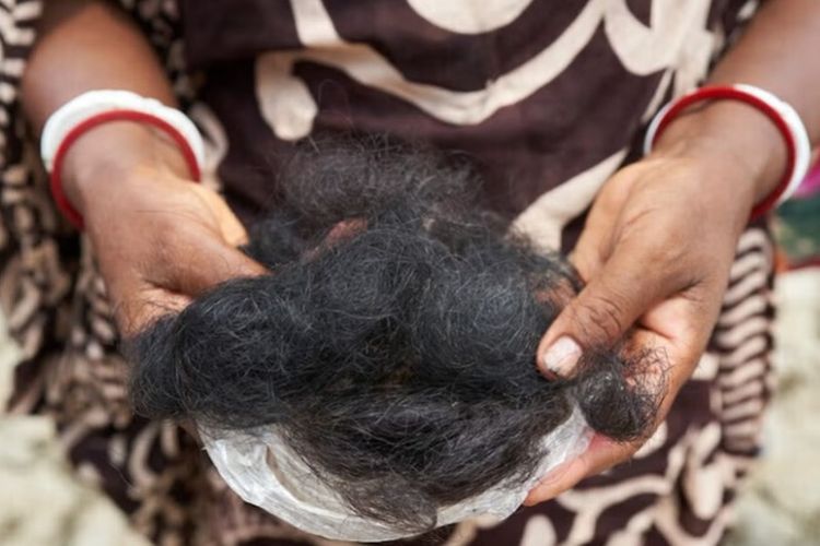 Shyamoli Munda memegangi rambut yang ia yakini rontok akibat mandi di air kolam yang terkontaminasi air asin dan pestisida pertanian.