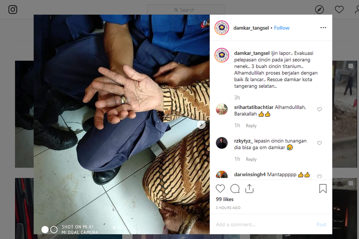 Seorang nenek meminta bantuan petugas damkar Tangsel untuk melepas tiga cincin di jari manisnya. Cincin itu telah menyumbat aliran darahnya.