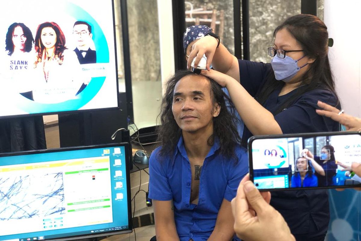 Cerita Kaka Slank transplantasi rambut saat konferensi pers di Farmanina Aesthetic & Hair Clinic, Selasa (24/5/2022).