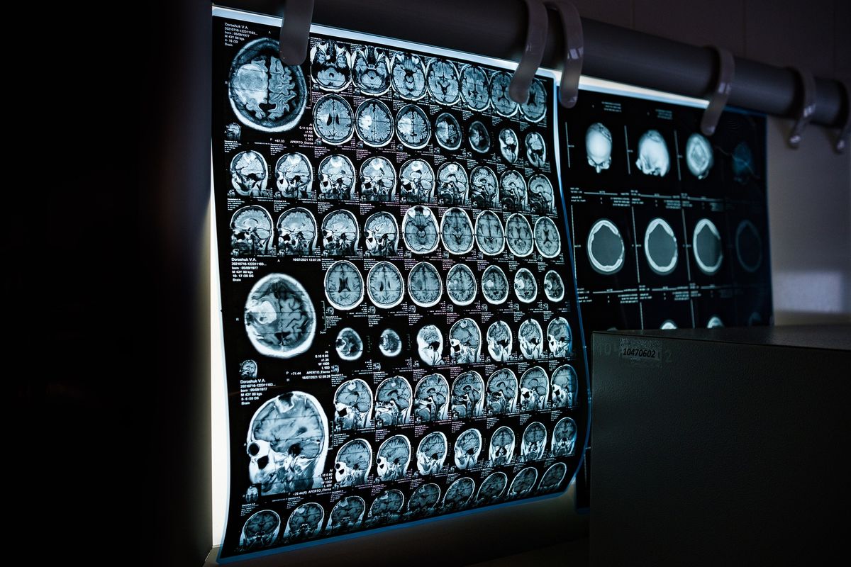 Apa yang Dimaksud dengan Radiologi?