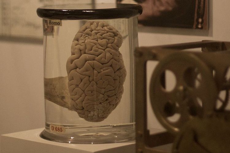 Ilustrasi otak Babbage yang dipamerkan di museum.