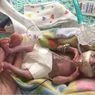 Berkat Sains, Bayi Paling Prematur di Dunia Kini Berusia 3 Tahun