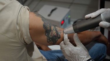 41 Warga di Situbondo Hapus Tato, Kapolres Situbondo: Gratis