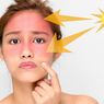 5 Bahan Kimia Sunscreen Penyebab Alergi Kulit